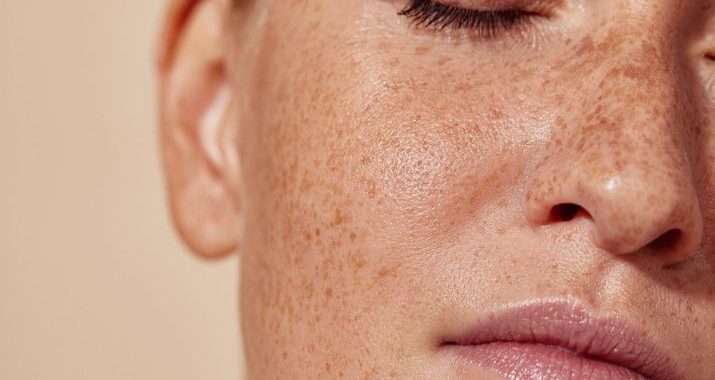 無痛脫毛與外泌體全攻略：香港市民的智慧美容選擇